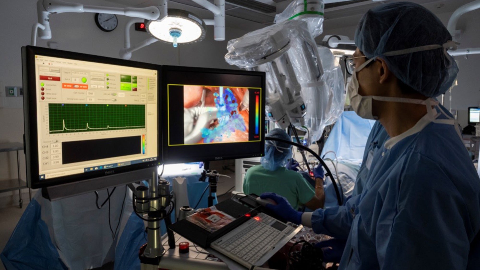 FLIm technology allows for augmented display of diagnostic information in the field of vision of the operating surgeon 