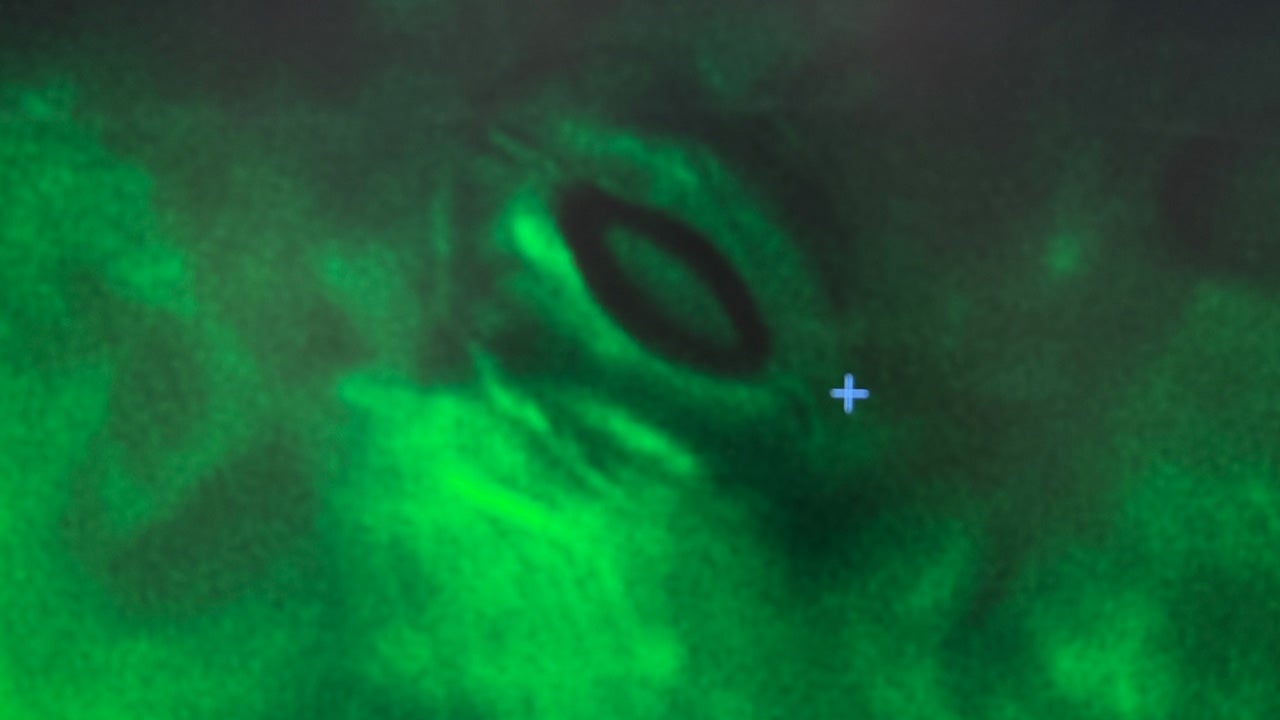 Abstract green background with a prominent dark oval shape and a blue cross.