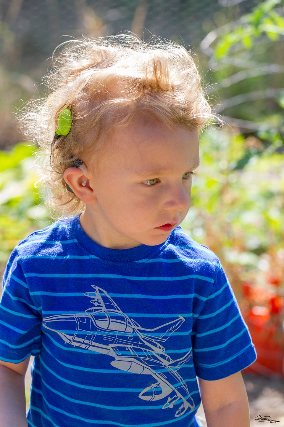 Child with cochlear implant.