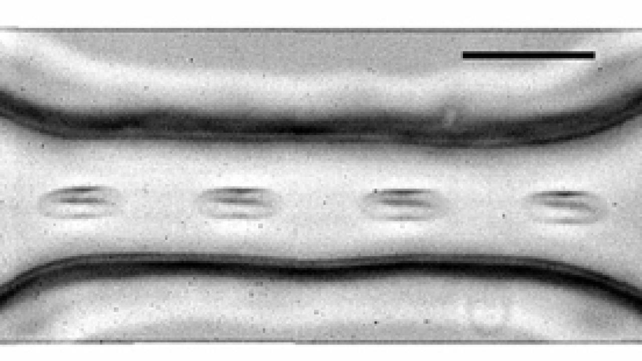 Red blood cells pass through a synthetic vessel that narrows and widens, mimicking the conditions of a constricted vessel.
