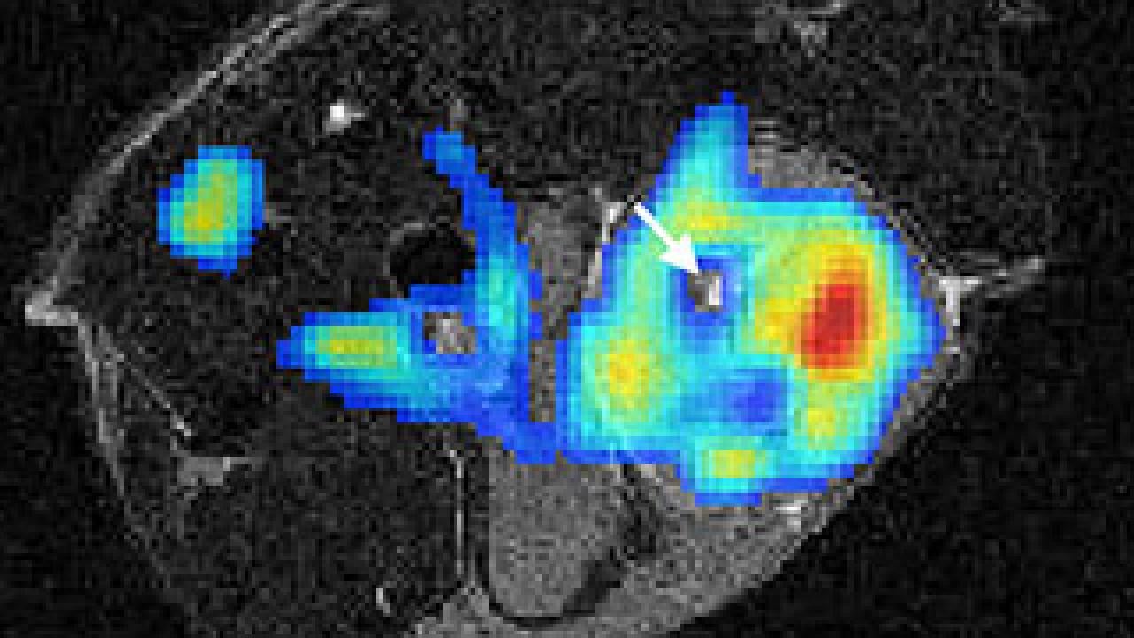 Image: scan of brain with colored spots