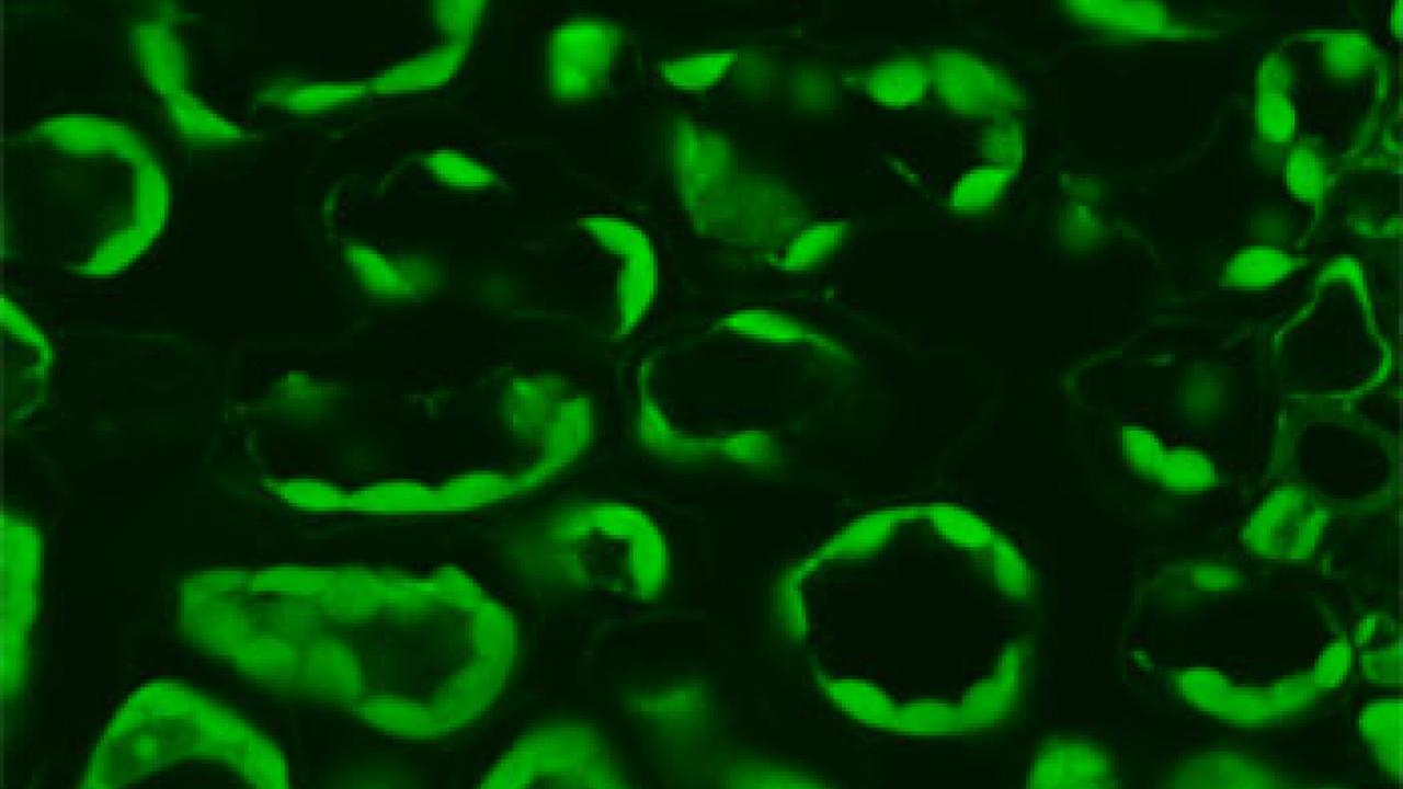 photo: a green fluorescent figures from seedlings on a black background