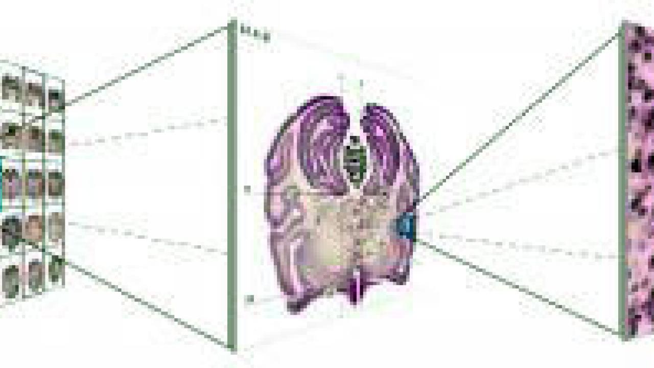 graphic: drawing with many brains on screen to one brain slice to a small portion of brain