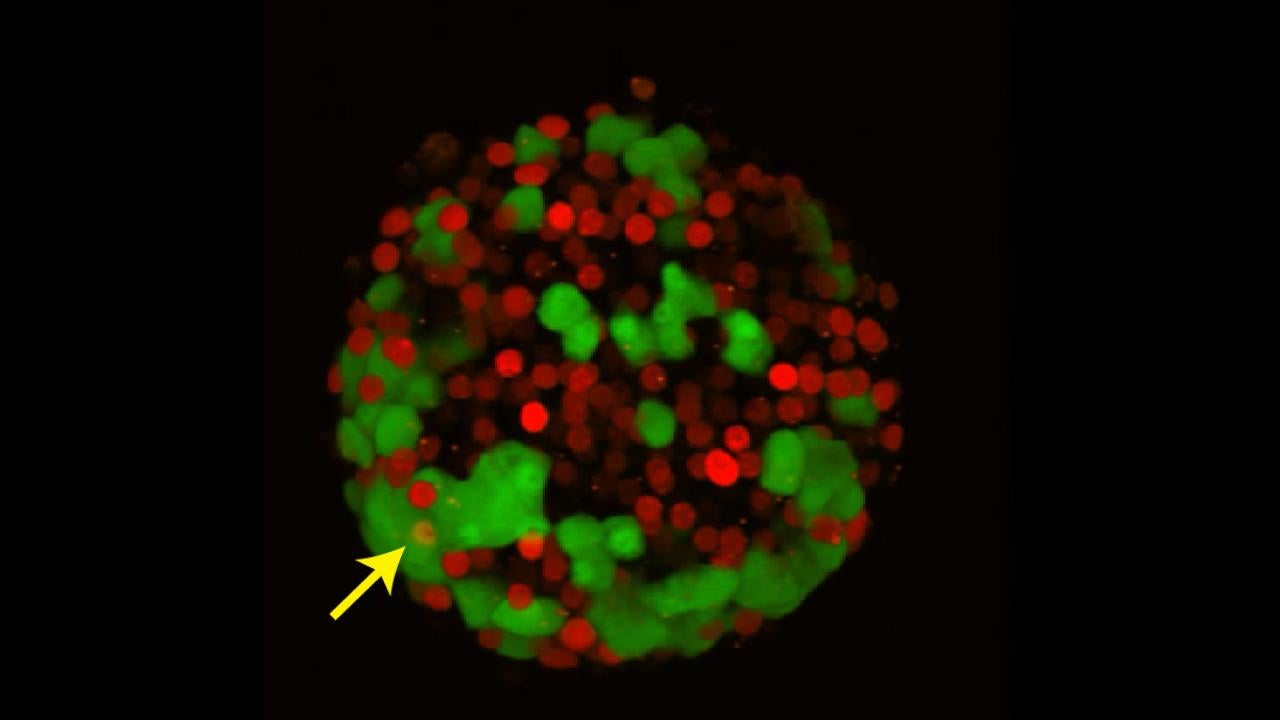 Pancreas islet with colored cells