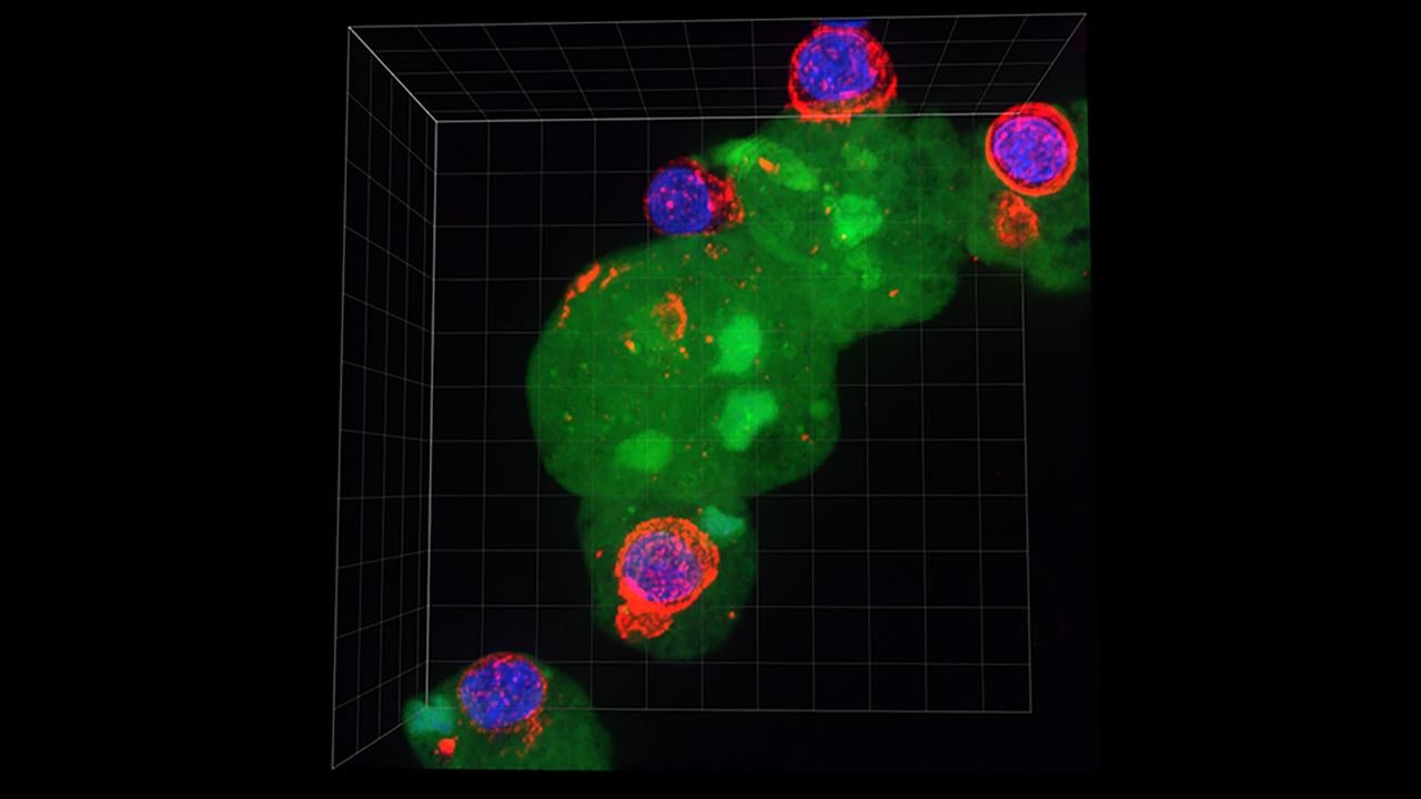 Amoeba eating other cells