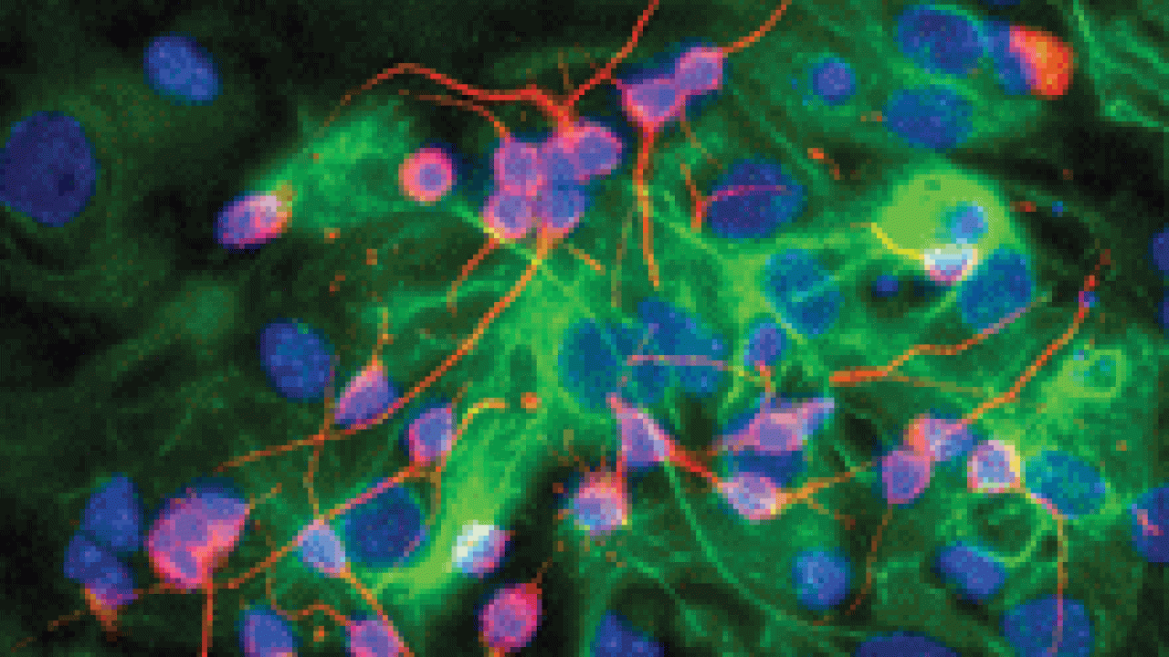 ABSTRACT PAINTING? No, it is a neural stem cell image created from a lab technique.