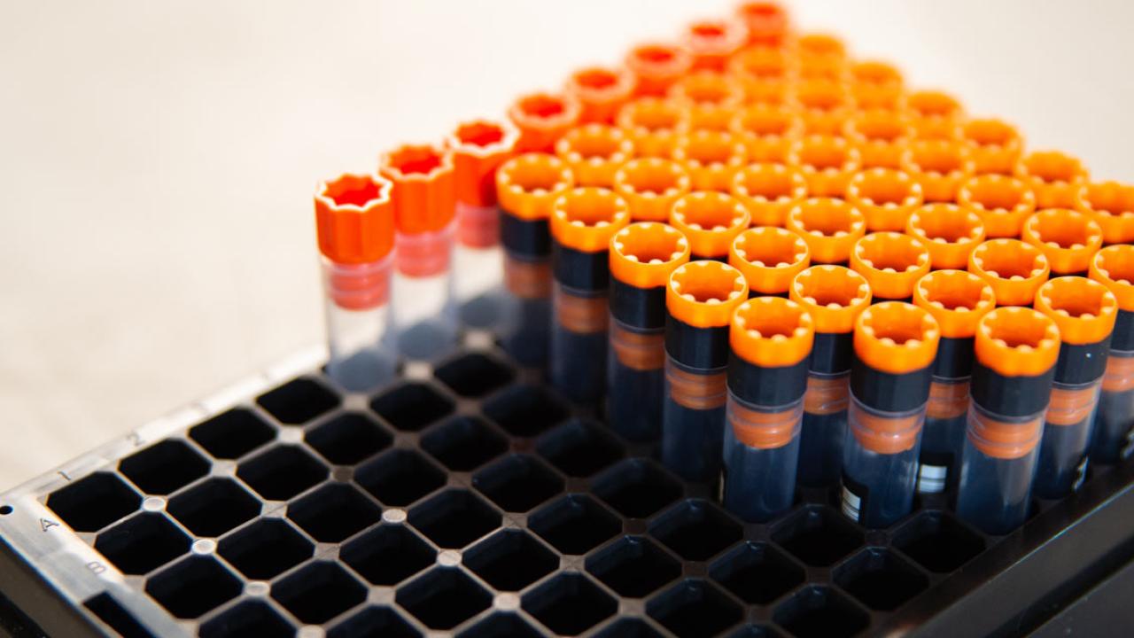 Test vials, with orange caps, in a tray