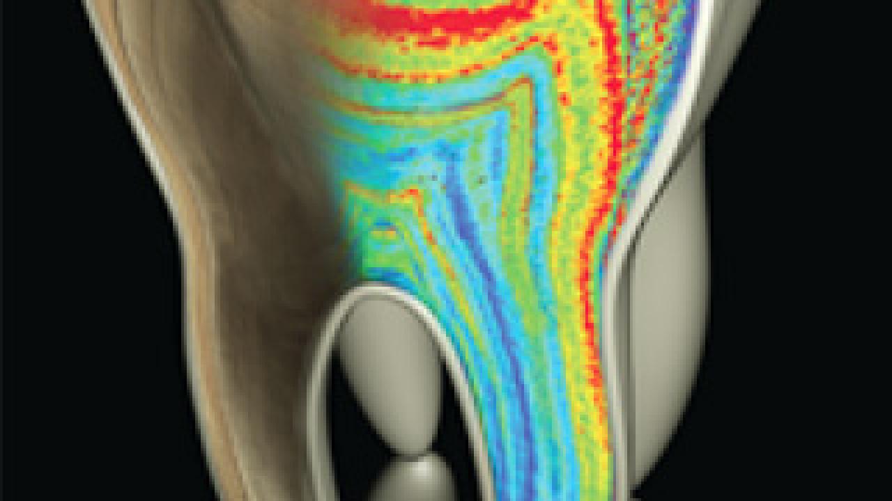 Graphic showing a tooth with various internal colored patterns