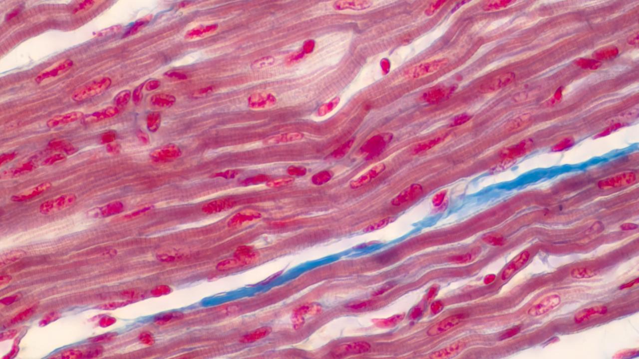 Red stripes cross the image from lower left to upper right. Darker red ovals are inside each stripe. 