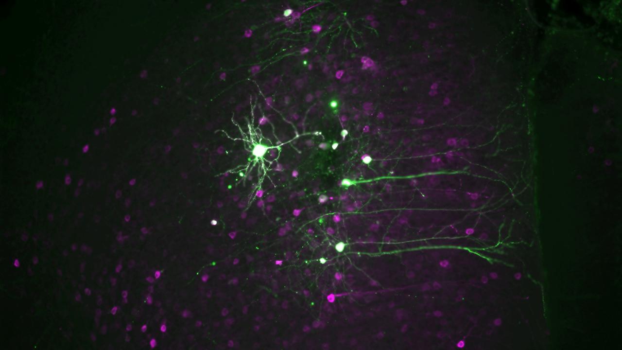 Green blobs connected by green tendrils over purple blobs in a roughly geometric pattern. The background is black. 
