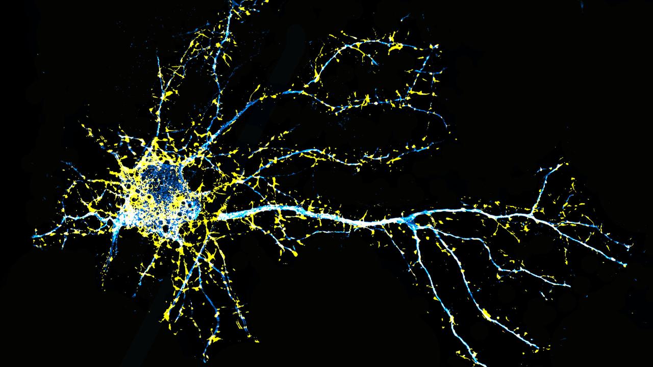 Spiky blue and yellow tendrils extend from a mass to the left of the image. Black background. 