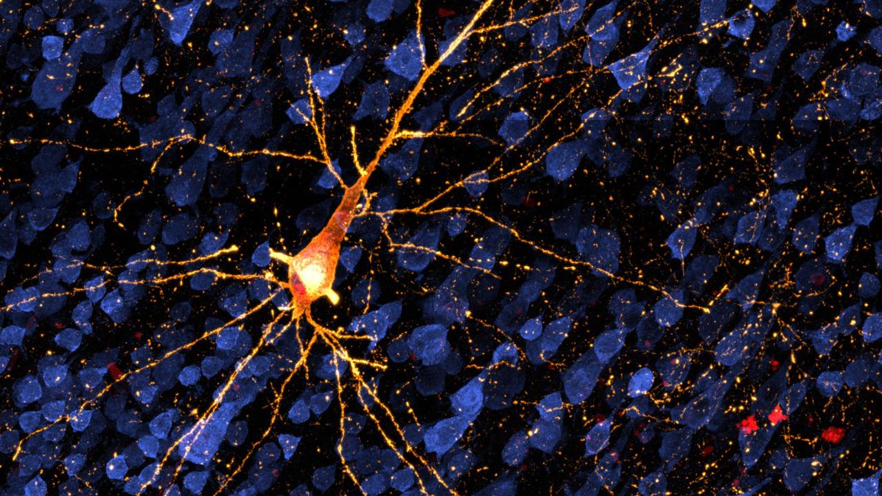 Yellow/orange blob with tendrils against a background of blue and black shapes.