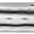 Red blood cells pass through a synthetic vessel that narrows and widens, mimicking the conditions of a constricted vessel.