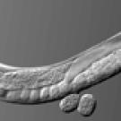 A photomicrograph of C. elegans worm, with the olfactory sensory neuron highlighted.