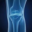 X-ray of knee