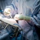 surgeon placing electrodes on a human brain for seizure and memory research