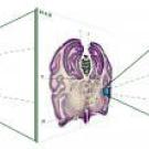 graphic: drawing with many brains on screen to one brain slice to a small portion of brain