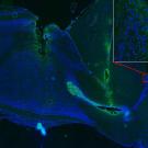 Section of rat brain