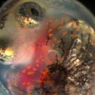 PHoto: embryo of a killfsh showing deformities