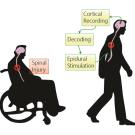 Graphic of treatment of spinal injury