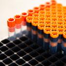 Test vials, with orange caps, in a tray