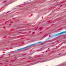 Red stripes cross the image from lower left to upper right. Darker red ovals are inside each stripe. 