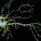 Spiky blue and yellow tendrils extend from a mass to the left of the image. Black background. 