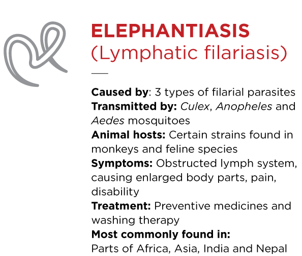 Elephantiasis